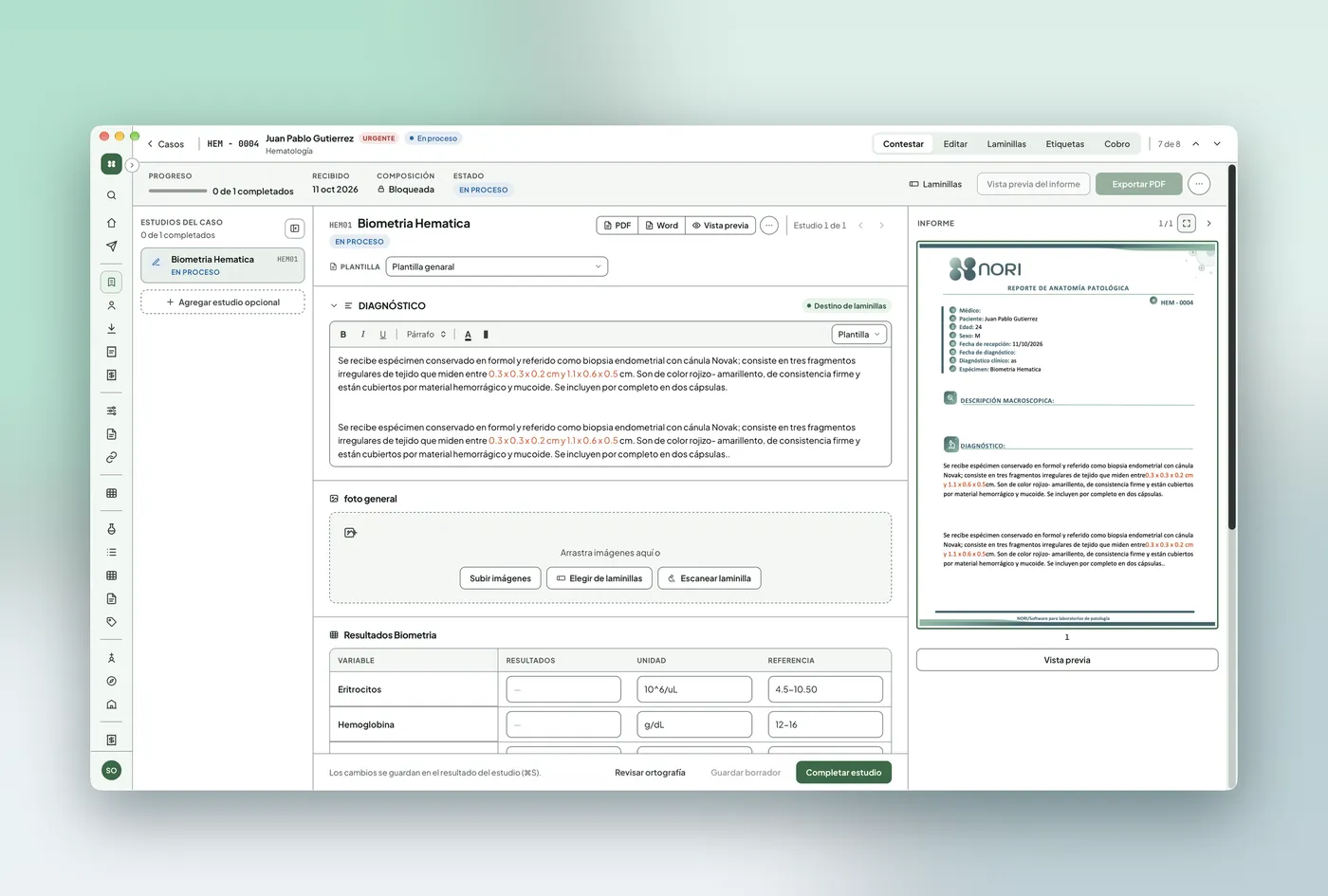 Captura de resultados de biometría hemática y vista previa del reporte en Nori