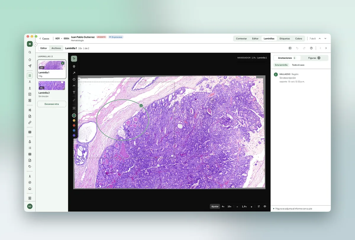 App de escritorio de Nori: visor de laminillas con anotaciones de patología